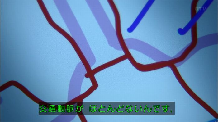 コード・ブルー4話のキャプ213