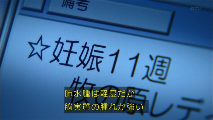コードブルー3話のキャプ271