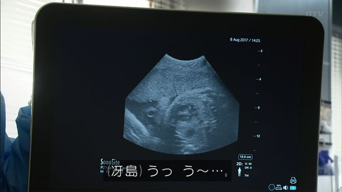 コード・ブルー5話のキャプ170