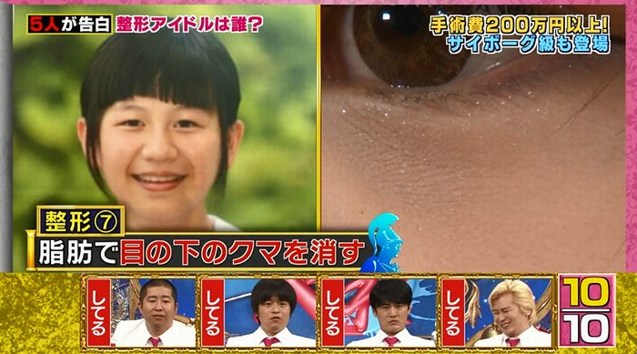 良かれと思ってのキャプ125