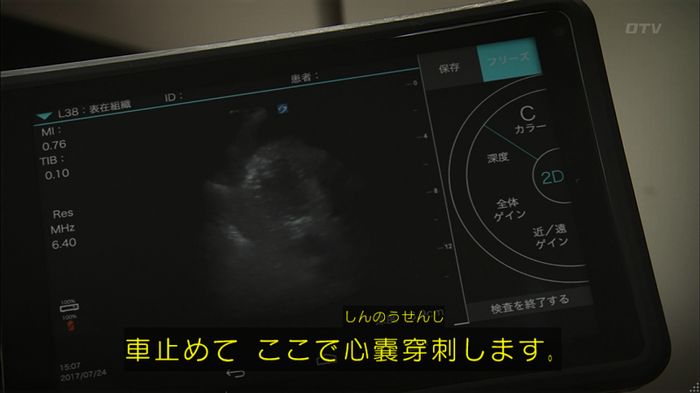 コード・ブルー2話のキャプ515