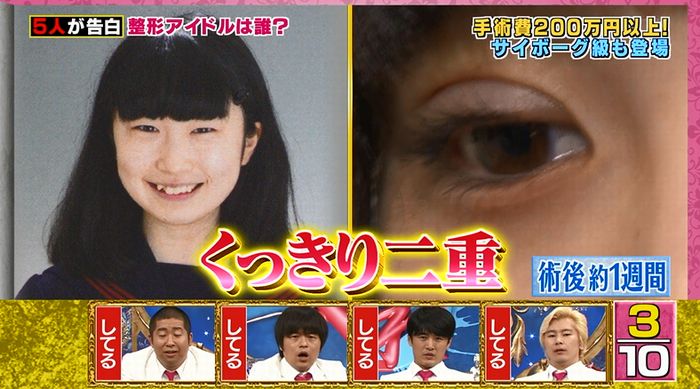 良かれと思ってのキャプ36