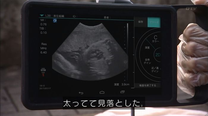 コードブルー 1話のキャプ410