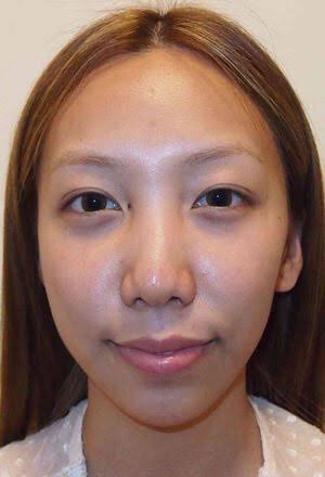 朗報 ざわちんさん いつの間にかめちゃくちゃ綺麗になるwwwwwww 株ログ速報 朗報 ざわちんさん いつの間にかめちゃくちゃ綺麗になるwwwwwww 株ログ速報