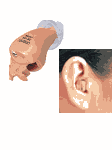 会う 生産的 もっともらしい オムロン 補聴器 部品 Ballet Aqua Jp